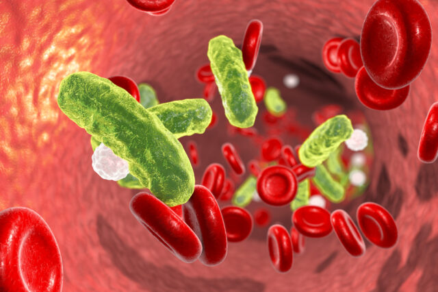 Sepsis Awareness in Nigeria: Prevention, Cure, and the Urgent Need for Public Education